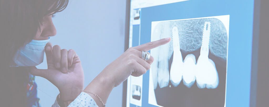 Elevation Endodontics |