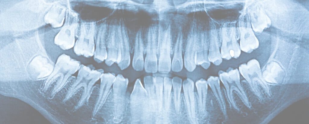 Elevation Endodontics |