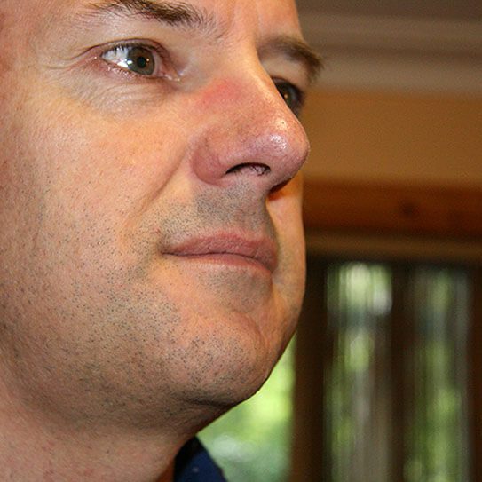 Endodontics Colorado Springs | Elevation Endodontics -