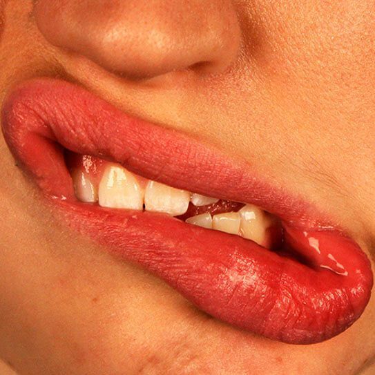 Endodontics Colorado Springs | Elevation Endodontics -