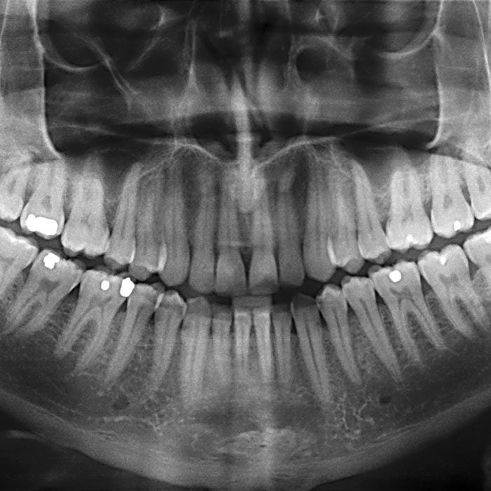 Endodontics Colorado Springs | Elevation Endodontics -