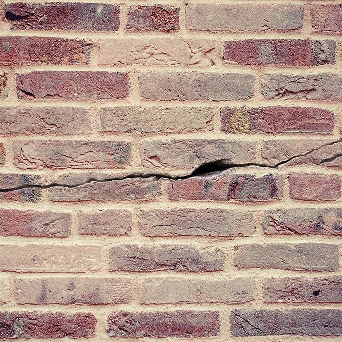 Endodontics Colorado Springs | Elevation Endodontics -