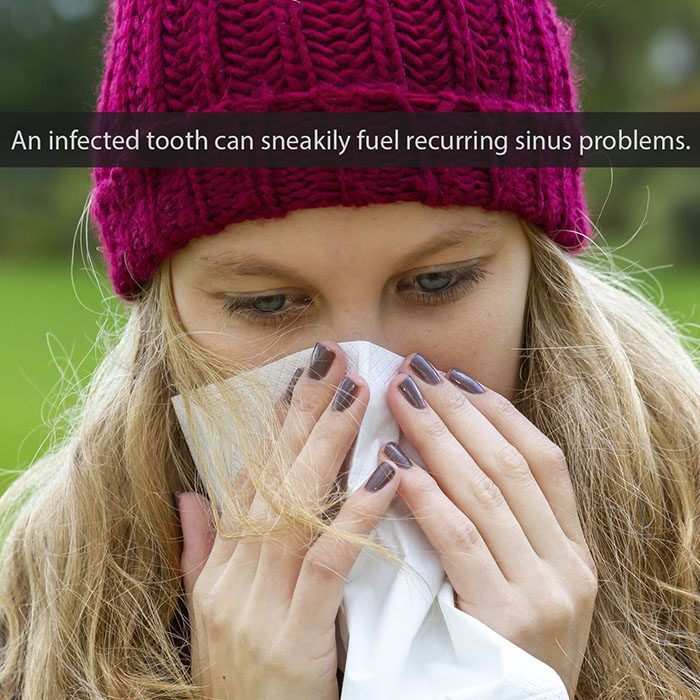 Endodontics Colorado Springs | Elevation Endodontics -