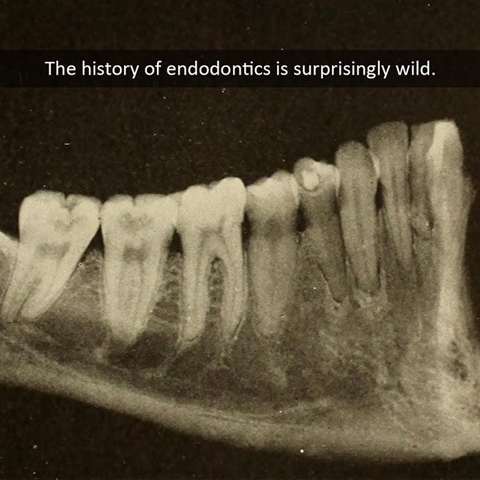 Elevation Endodontics |