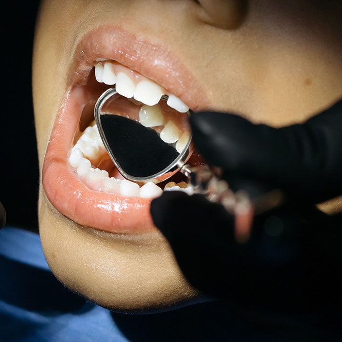 Elevation Endodontics |