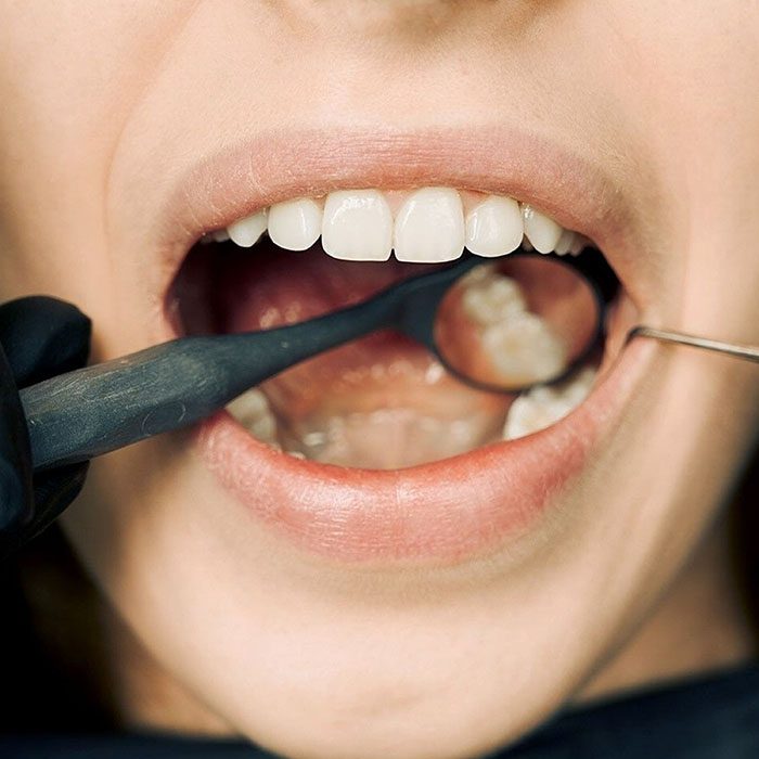 Elevation Endodontics |