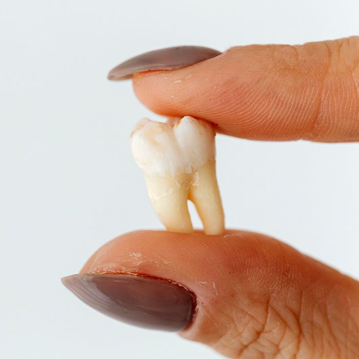 Elevation Endodontics |
