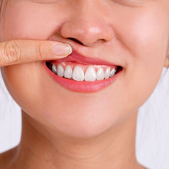 Elevation Endodontics |