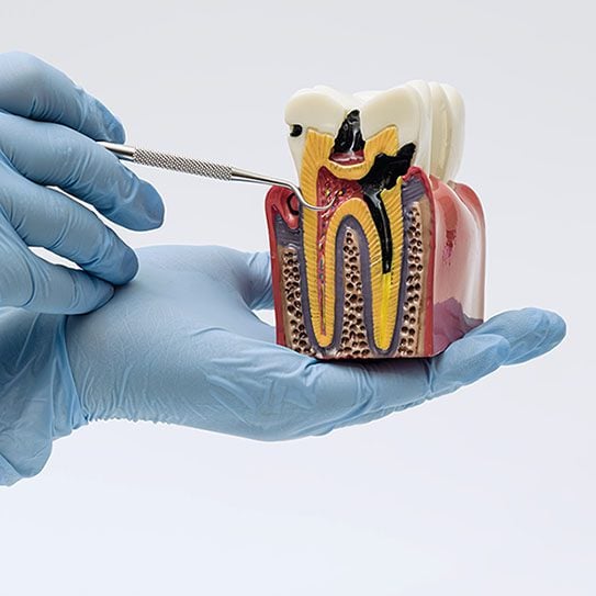 Endodontics Colorado Springs | Elevation Endodontics -