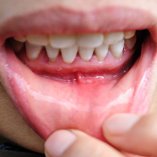 Endodontics Colorado Springs | Elevation Endodontics -